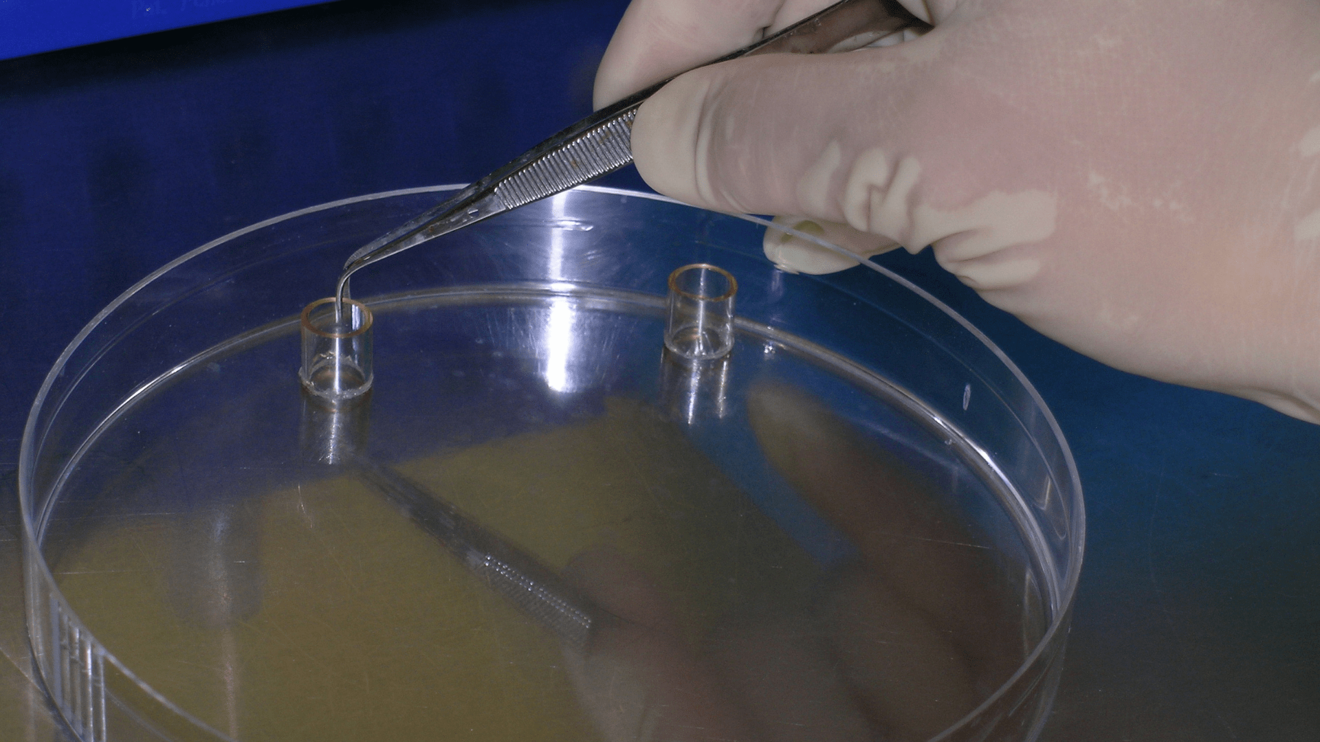A close-up of a petri dish and a scientist’s hand in a latex glove holding tweezers. They are cloning a human cell-line colony being in vitro through use of cloning rings.