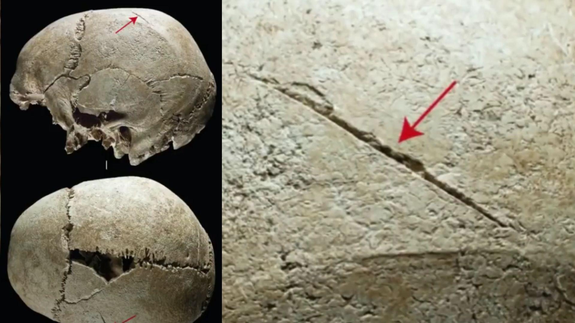 Close up of skulls from the Middle Ages found in a mass grave in Dorset, England