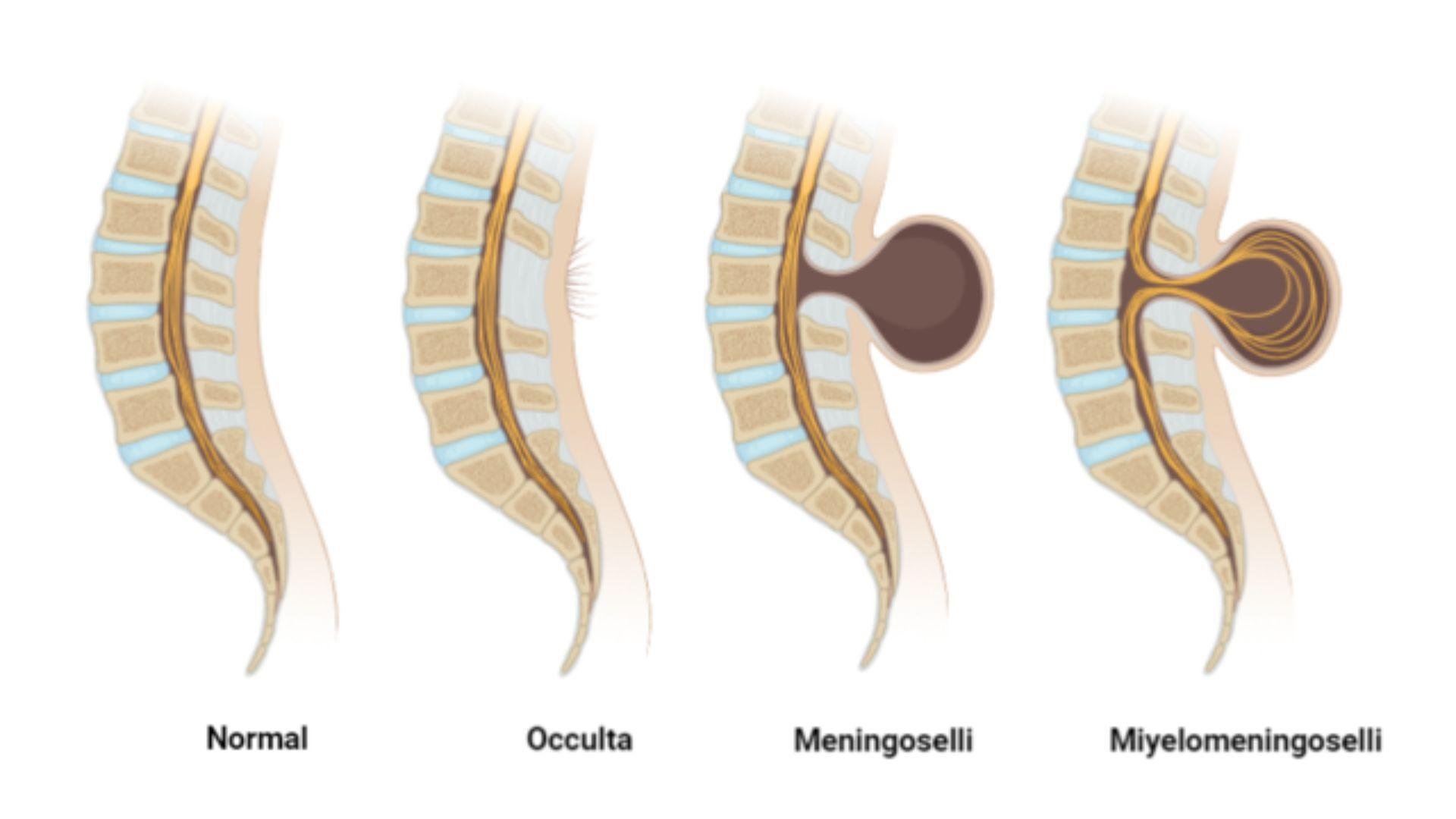 Scientists Finally Answer the Question: Why Don’t Humans Have Tails?