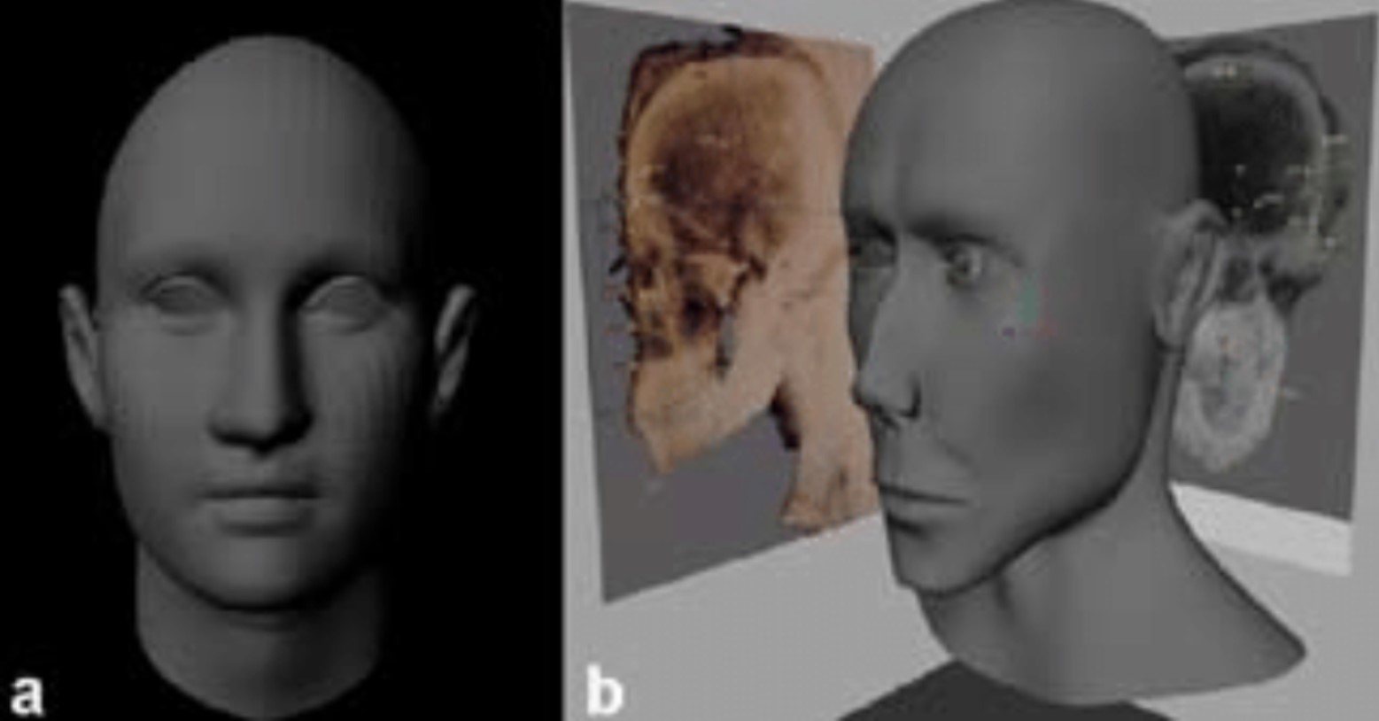 Digital reconstructions of the faces of Aebuita and Cavilio from their mummies outside of Rome