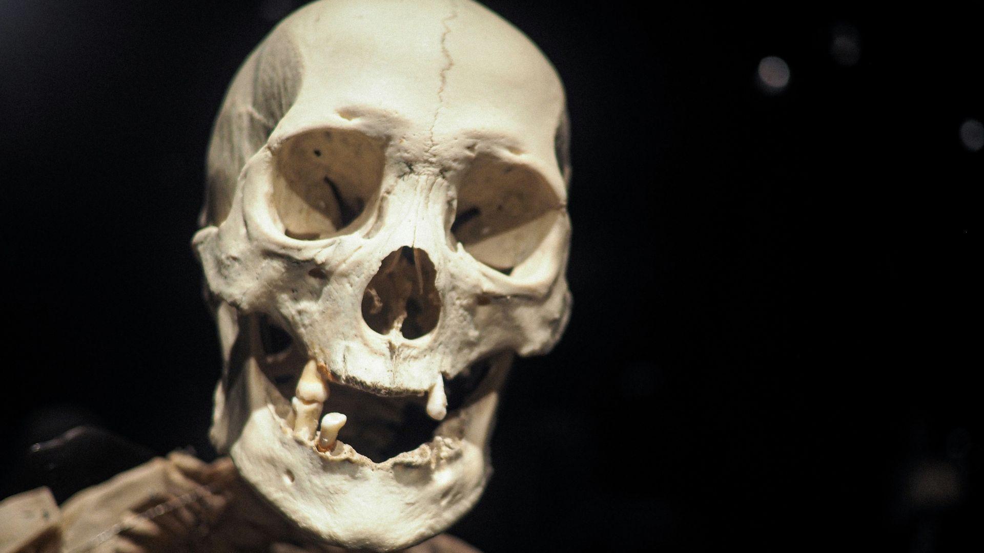 A close-up view of an old human skull in a museum against a black background.