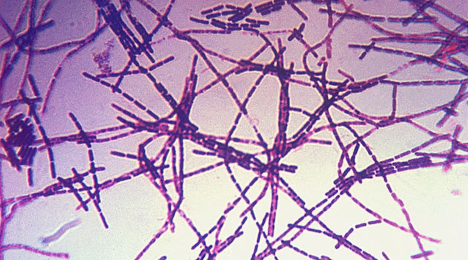A microscopic view of anthrax. There are purple lines interwoven.