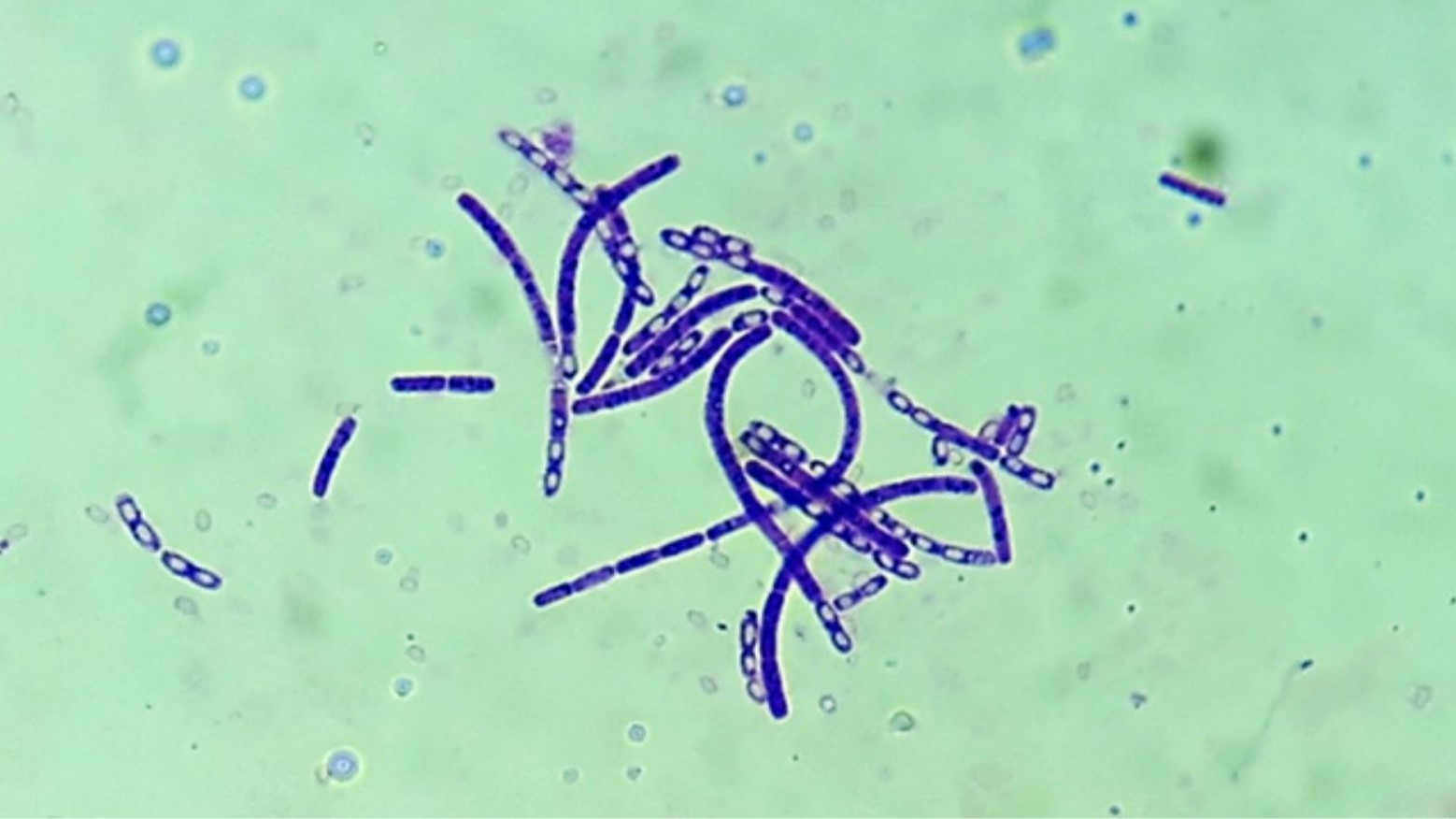 A microscopic view of anthrax. There are blue dots and lines against a green background.