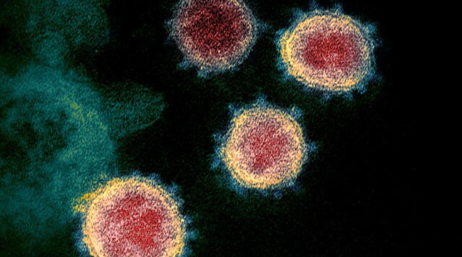 A close-up of SARS. There are red, yellow, and green circles against a black background.
