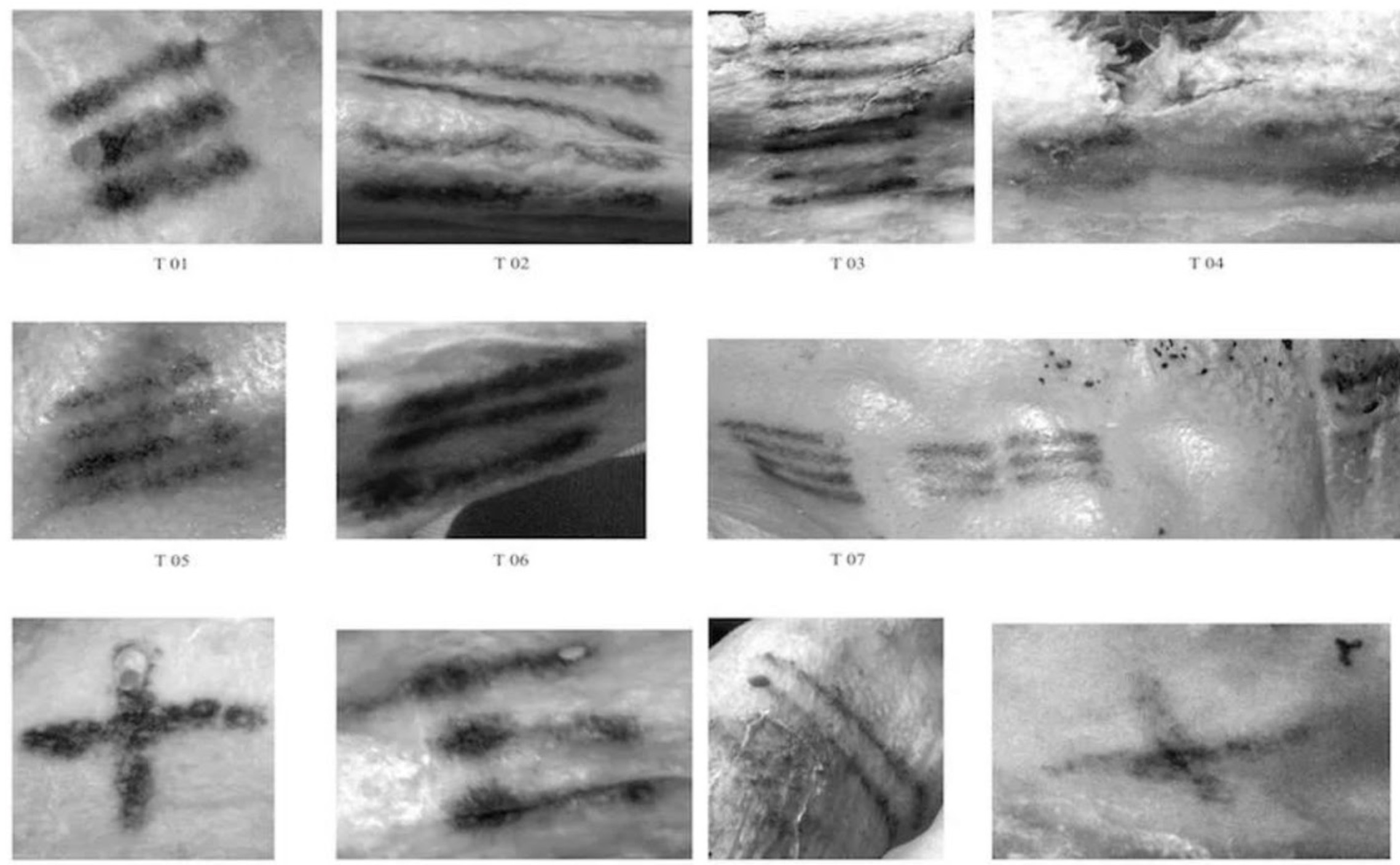 Several photographs of the tattoos of Ötzi the Iceman