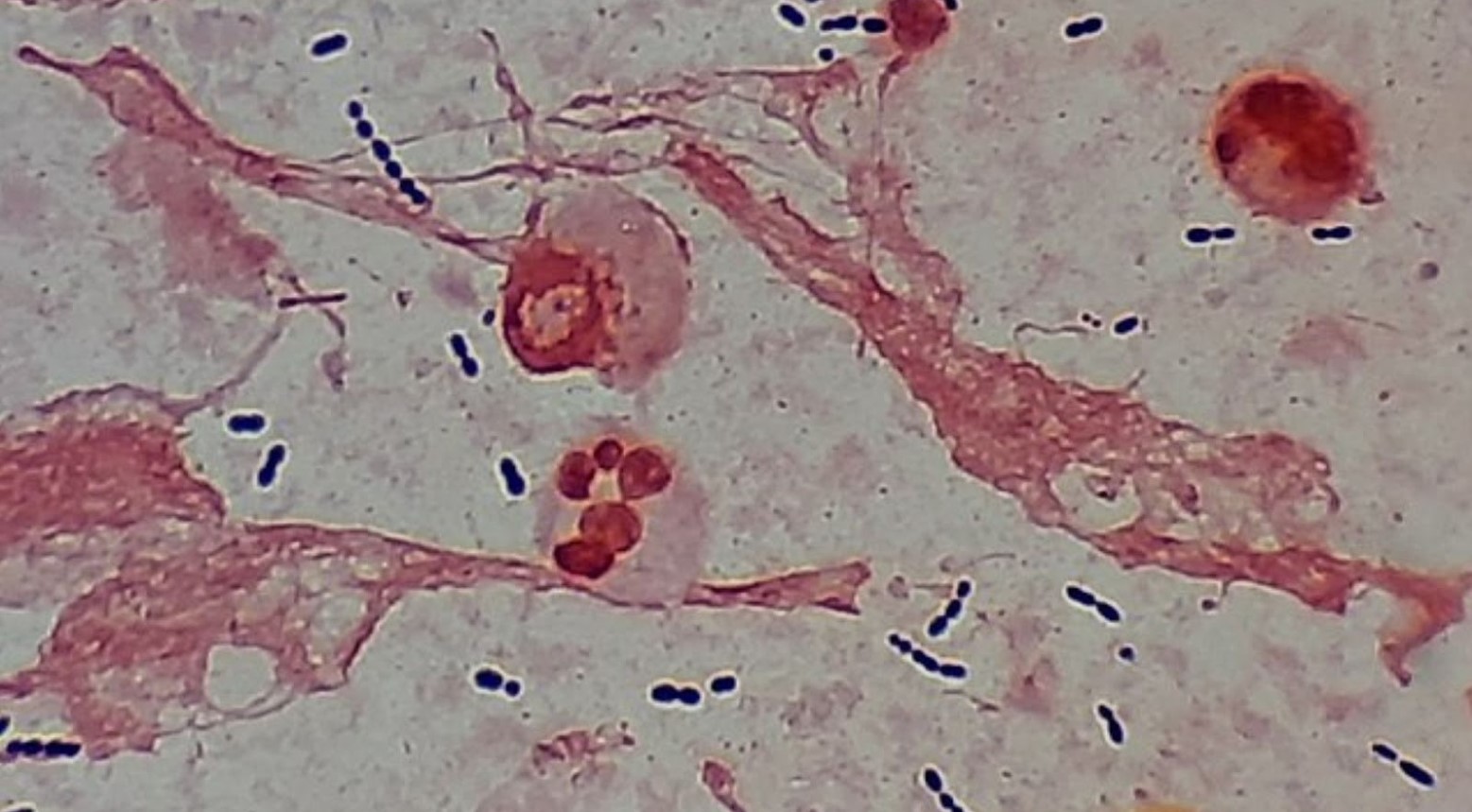 A view of bacteria from a microscope. Large patches of red and some black dots are against a white surface.