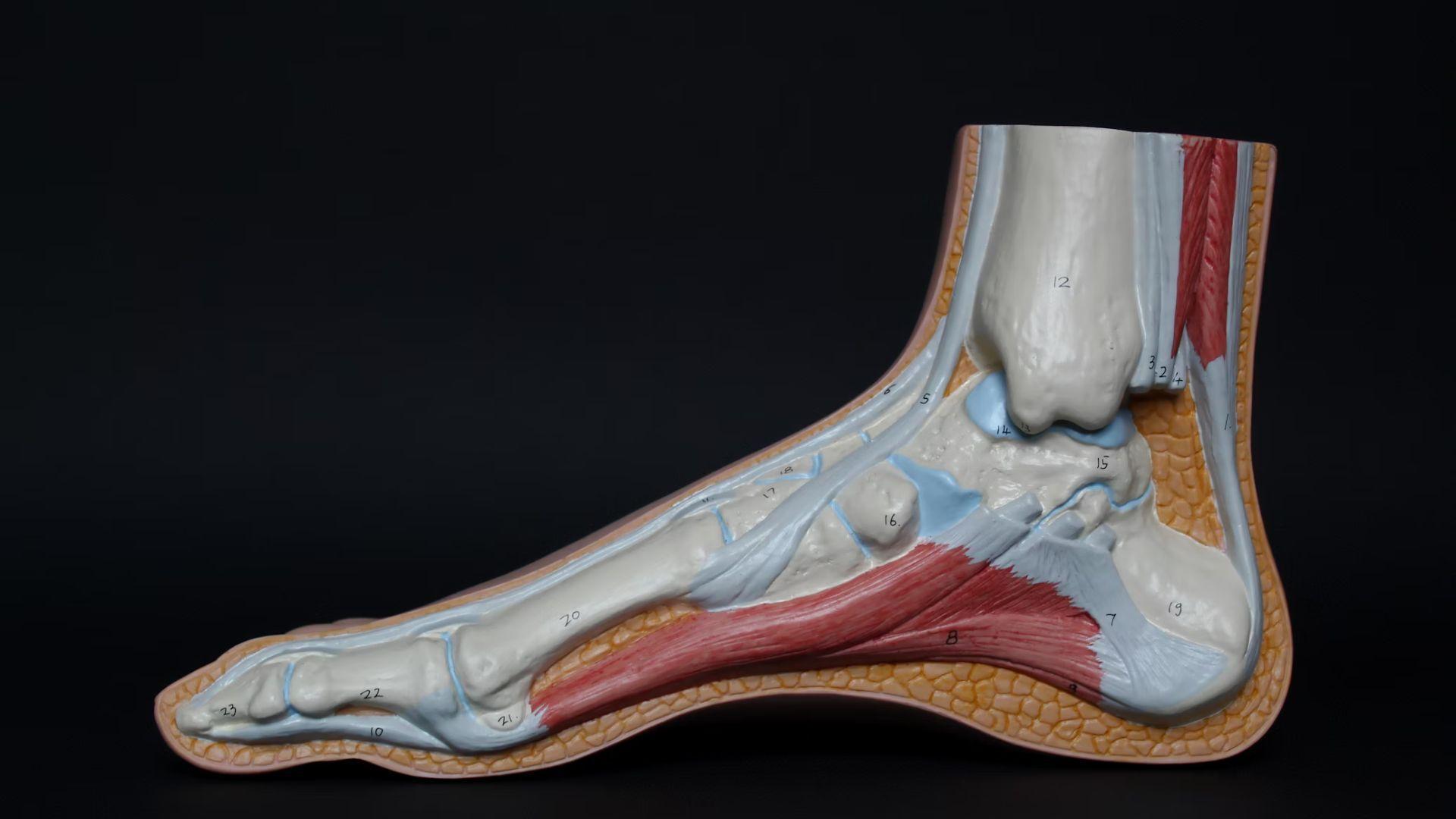 An example of an Achilles heel.