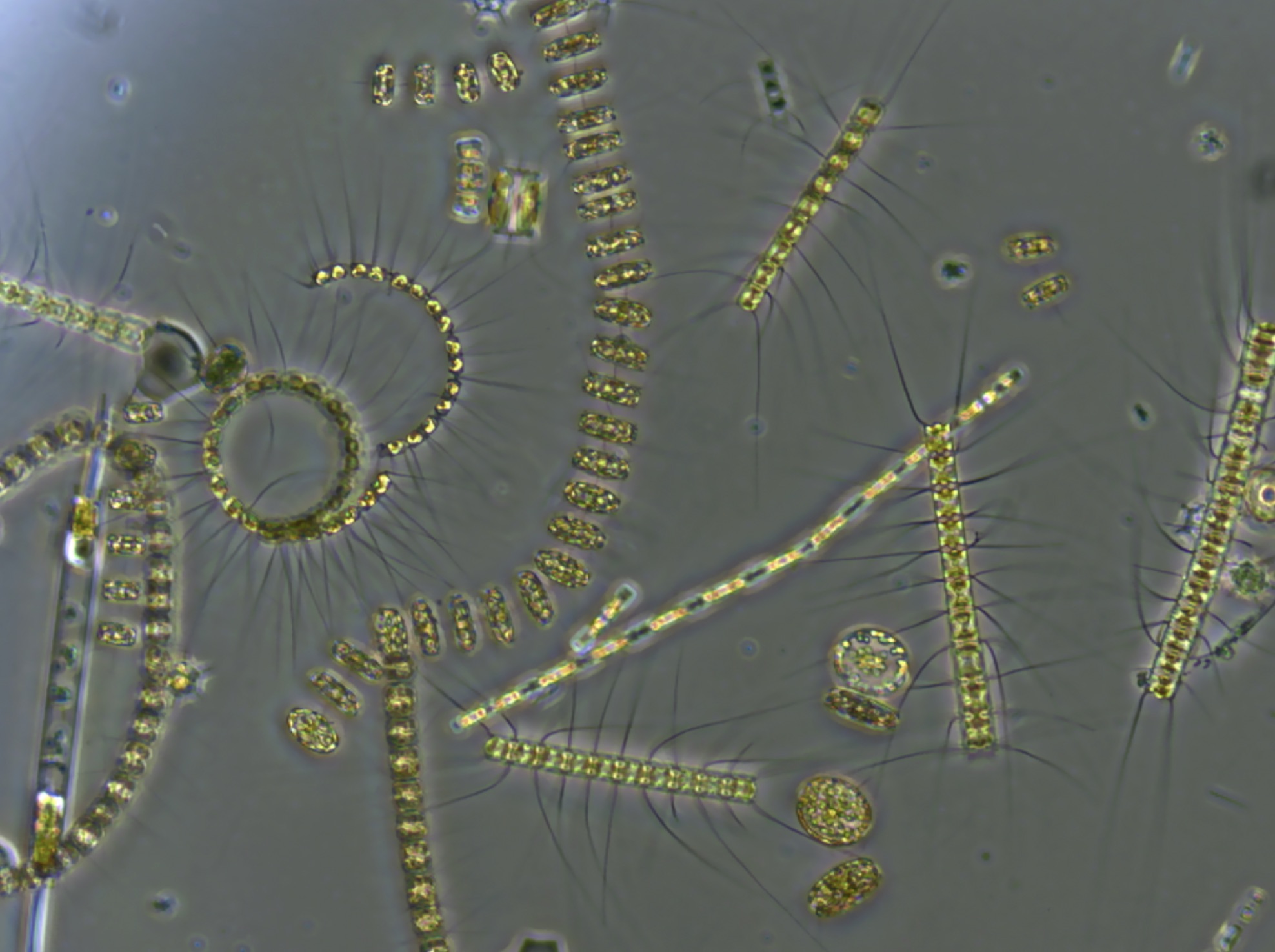 A microscopic photograph of phytoplankton that thrive on the ocean floors