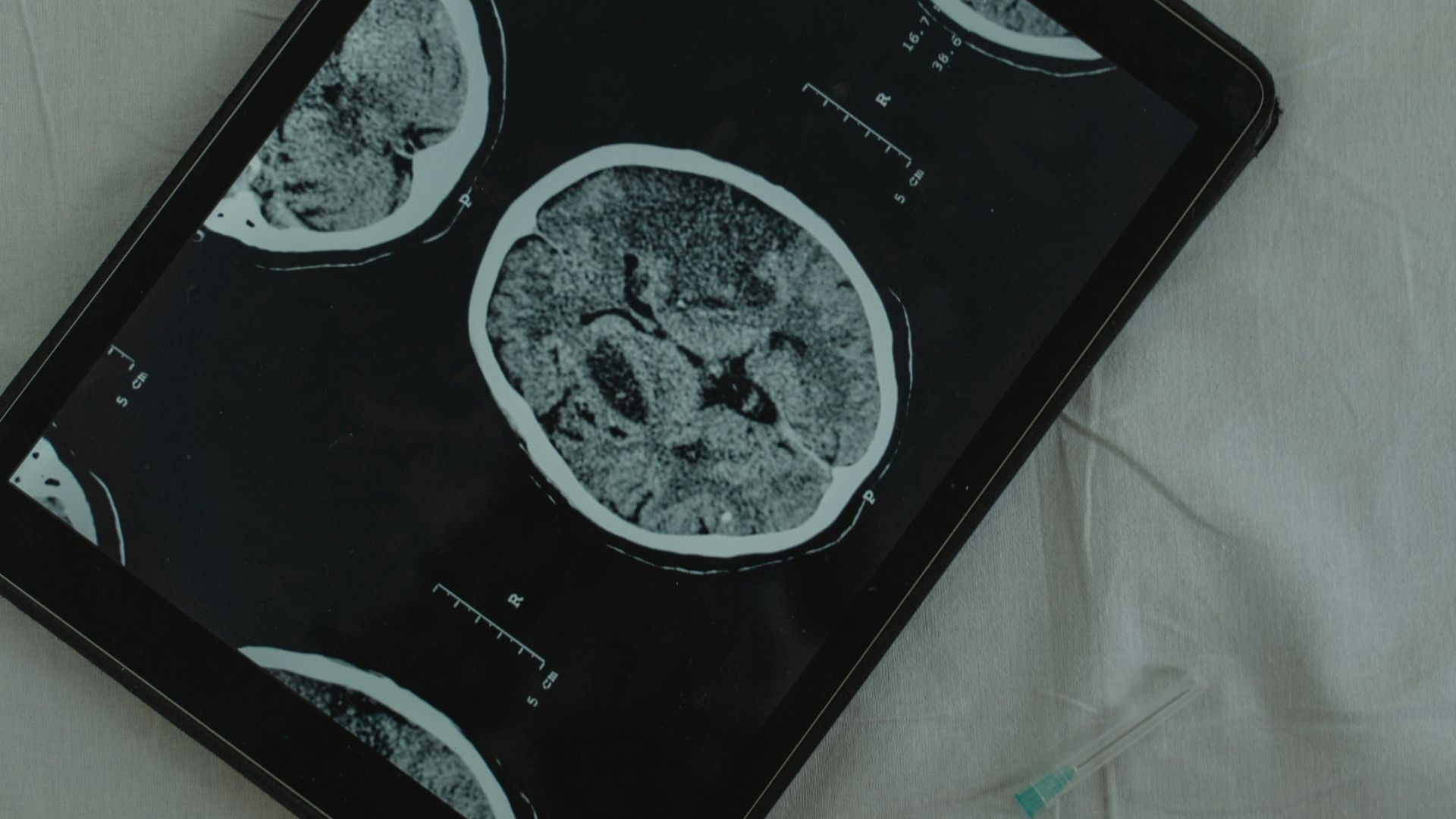 A close-up of brain scans on a tablet.