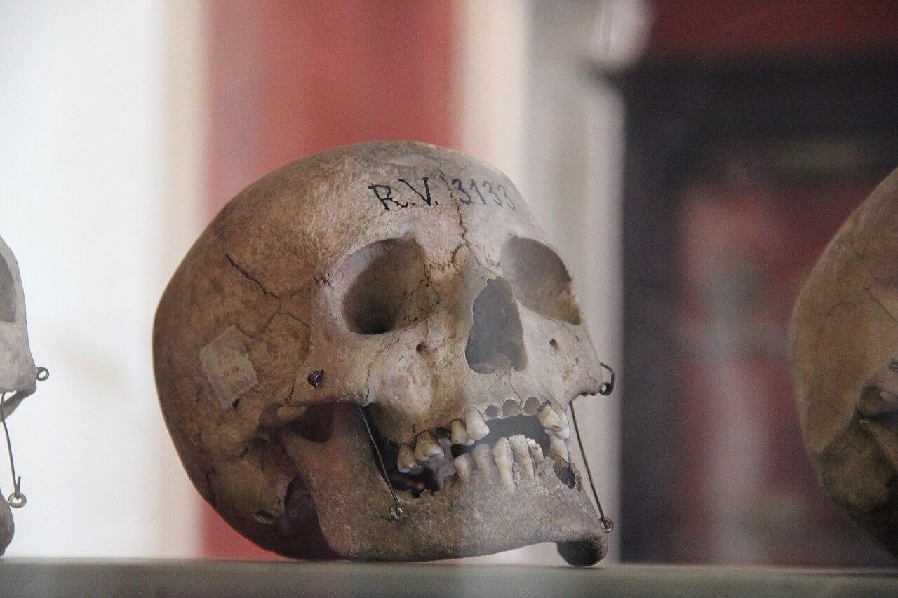 A photograph of a human skull