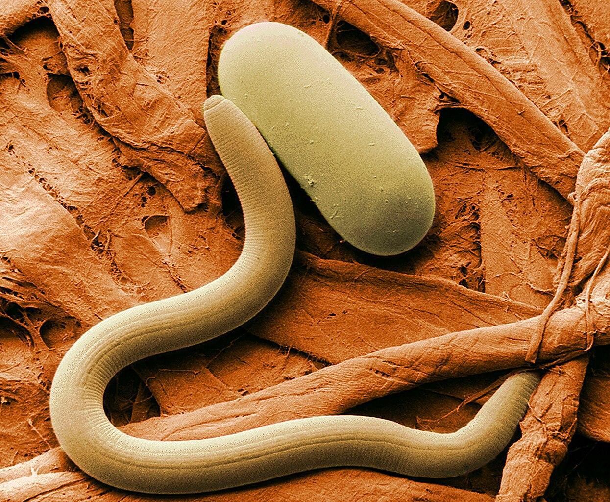 A microscopic image of a nematode