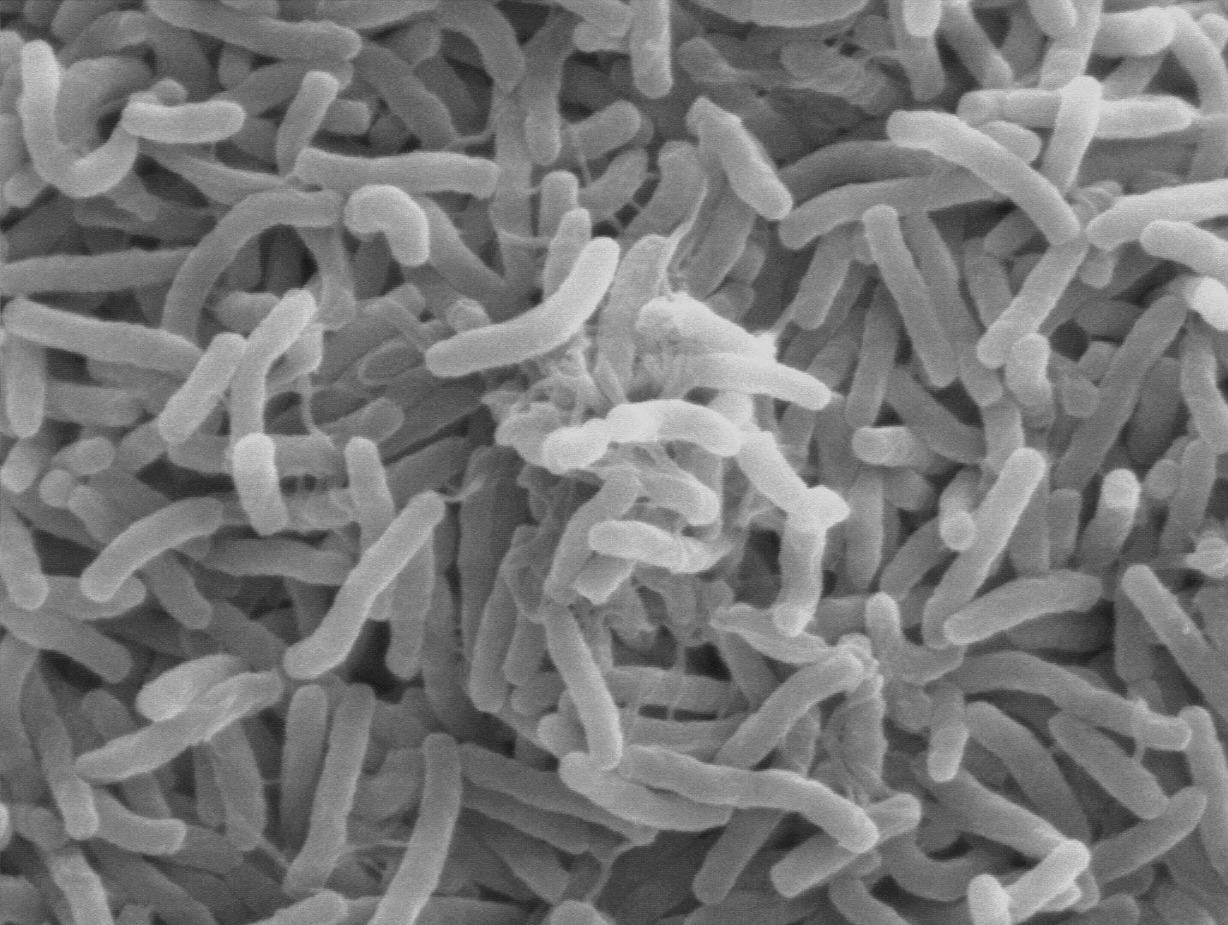 A photograph taken of germs found underneath a microscope