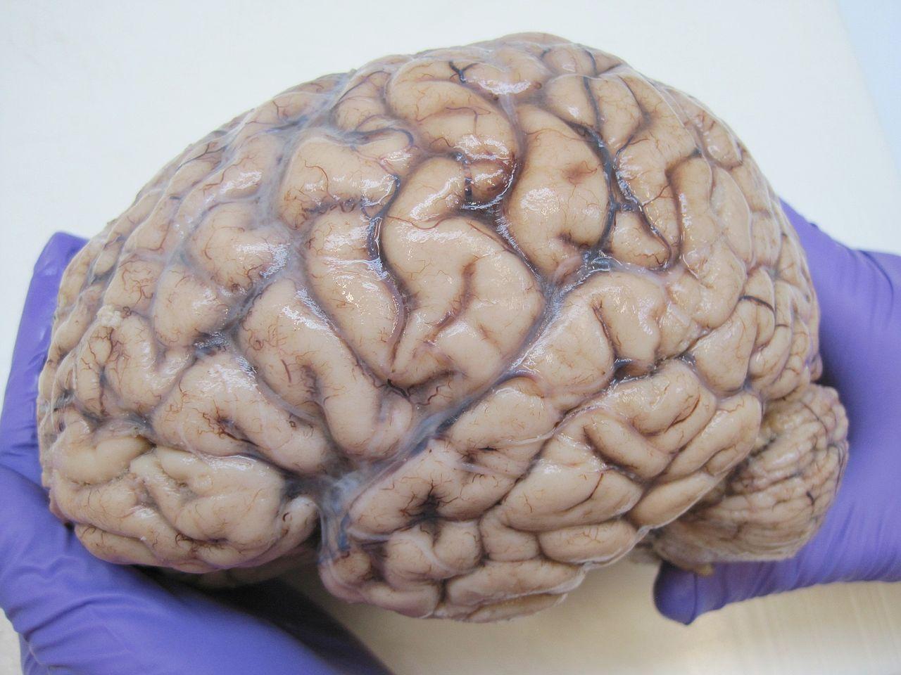 A photograph of a human brain