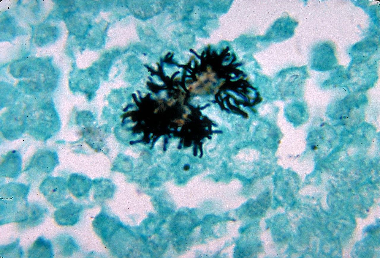 A photograph of Actinobacteria taken using a powerful microscope