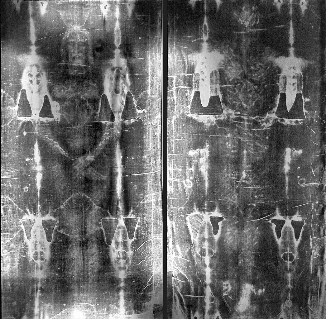 X-ray negatives taken of the Shroud of Turin